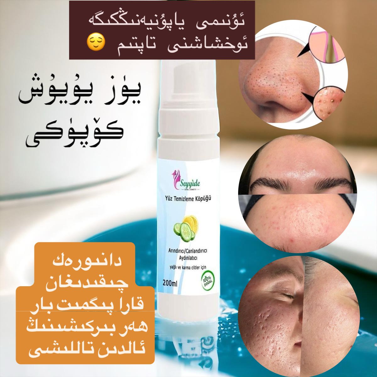 تېرە ئاسىراش يۈرۈشلۈكى4مەھسۇلات — 2